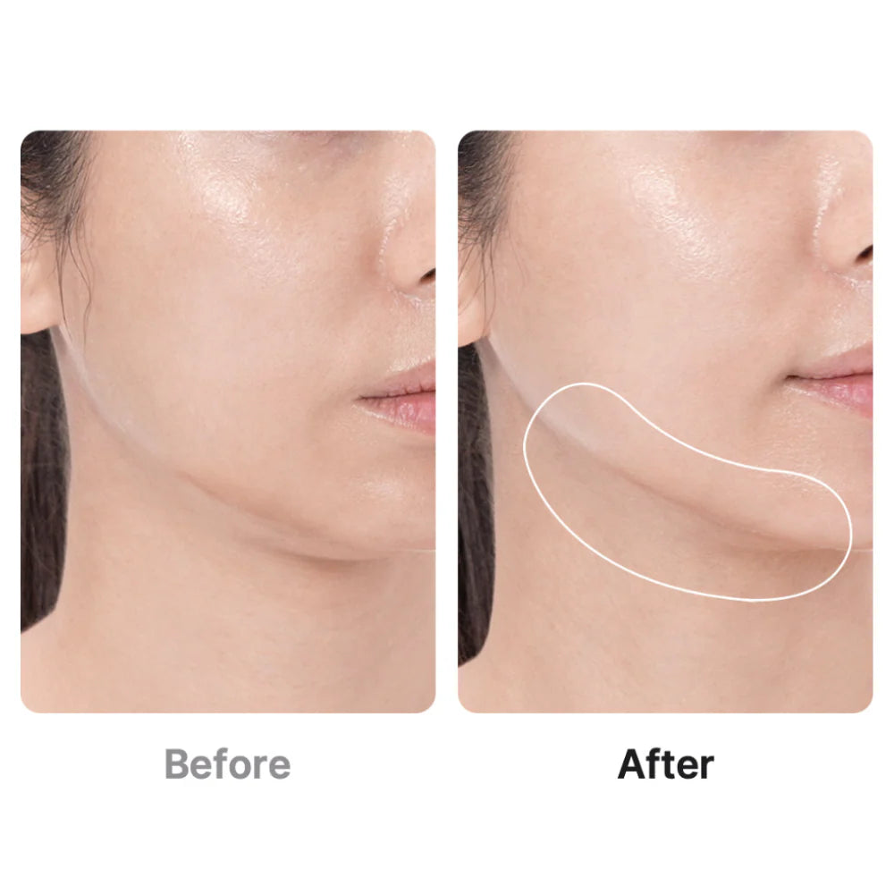 Medicube AGE-R Mini Booster Pro (White)