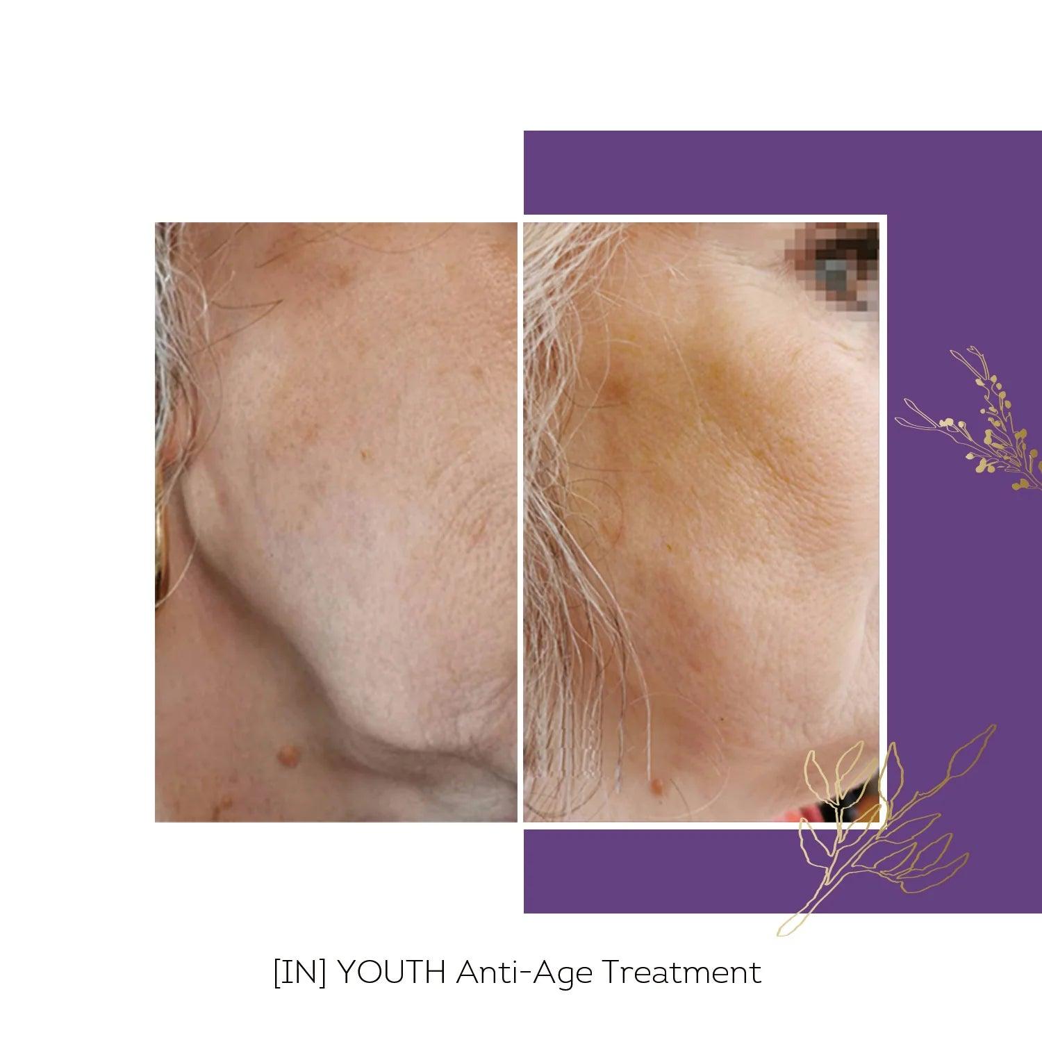 Floreve YOUTH Anti-Aging Boosters 10 shots