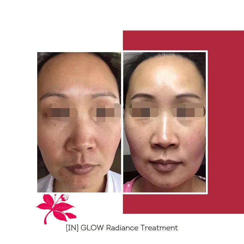 Floreve GLOW Radiance boosters 10 shots